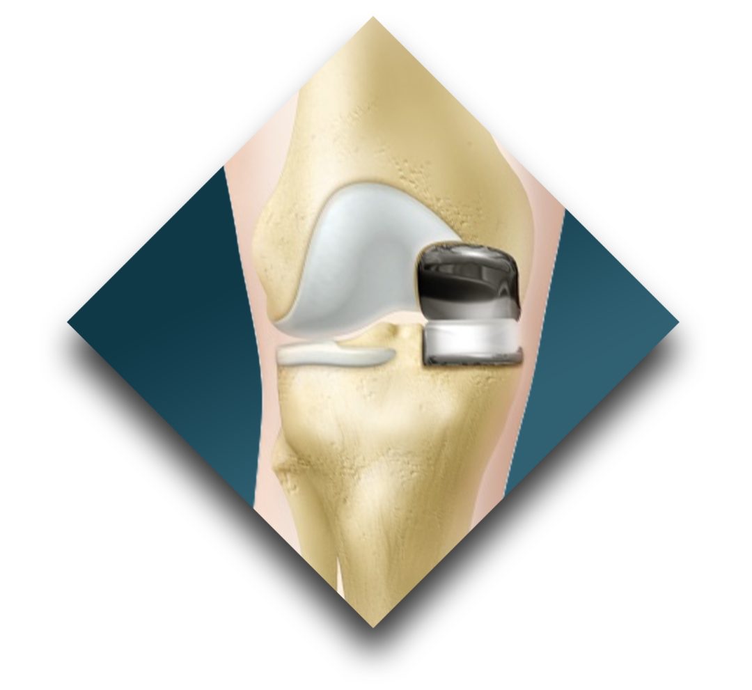 Home davidson orthopedics